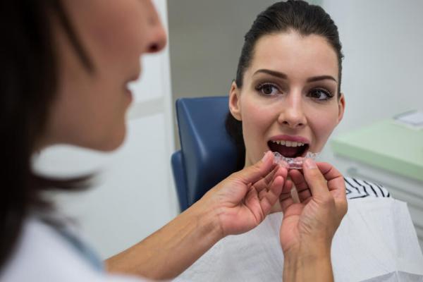 Inserting clear aligner