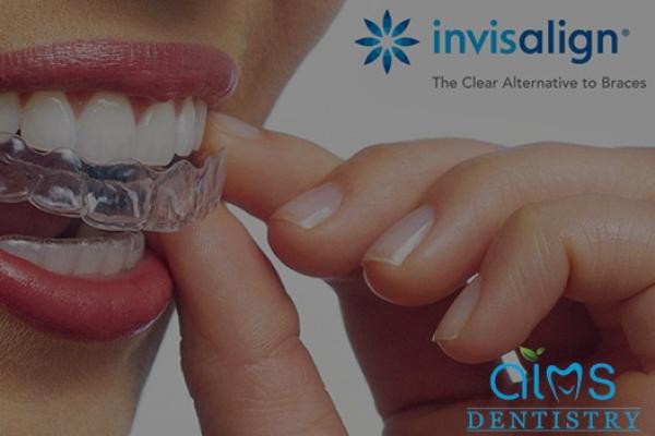 Invisalign clear aligner